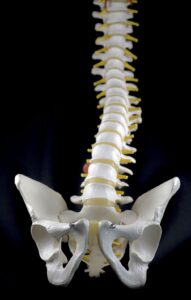 Scoliosis