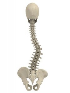 A scoliosis spine